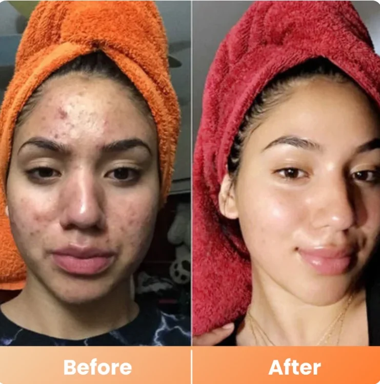 Dr. Melaxin Peel Shot PS Spray
